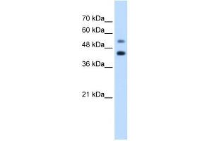 GTPBP2 antibody used at 1. (GTPBP2 抗体  (C-Term))