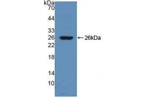 Detection of Recombinant DNM1, Mouse using Polyclonal Antibody to Dynamin 1 (DNM1)