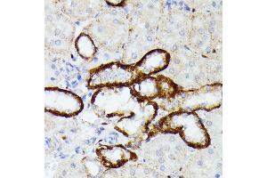 Immunohistochemistry of paraffin-embedded rat kidney using MT-ND5 antibody (ABIN7268603) at dilution of 1:100 (40x lens).
