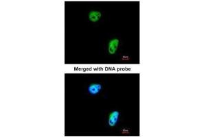 ICC/IF Image Immunofluorescence analysis of paraformaldehyde-fixed HeLa, using TLK1, antibody at 1:200 dilution. (TLK1 抗体)