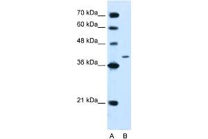 WB Suggested Anti-PTPN2 Antibody Titration:  2. (PTPN2 抗体  (N-Term))