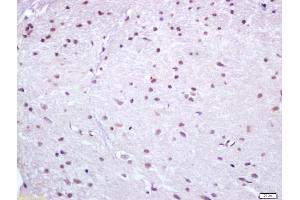 Formalin-fixed and paraffin embedded rat brain labeled with Anti Nur77 Polyclonal Antibody (ABIN747443), Unconjugated at 1:200, followed by conjugation to the secondary antibody and DAB staining (NR4A1 抗体  (AA 351-450))