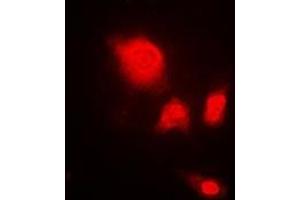Immunofluorescent analysis of UCH-L5 staining in A549 cells. (UCHL5 抗体)