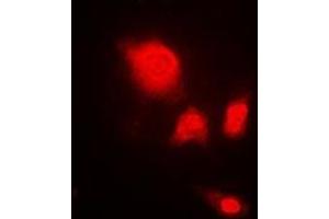 Immunofluorescent analysis of UCH-L5 staining in A549 cells.