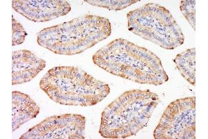 Paraformaldehyde-fixed, paraffin embedded mouse intestine, Antigen retrieval by boiling in sodium citrate buffer (pH6) for 15min, Block endogenous peroxidase by 3% hydrogen peroxide for 30 minutes, Blocking buffer (normal goat serum) at 37°C for 20min, Antibody incubation with Integrin alpha 3 Polyclonal Antibody, Unconjugated  at 1:200 overnight at 4°C, followed by a conjugated secondary and DAB staining. (ITGA3 抗体  (AA 976-1025))
