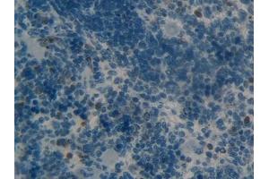 Immunohistochemistry (IHC) image for anti-Matrix Metallopeptidase 9 (Gelatinase B, 92kDa Gelatinase, 92kDa Type IV Collagenase) (MMP9) (AA 226-391) antibody (ABIN7432019)