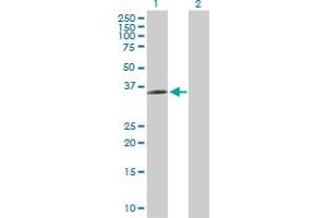 Western Blot analysis of BDKRB1 expression in transfected 293T cell line by BDKRB1 MaxPab polyclonal antibody. (BDKRB1 抗体  (AA 1-353))