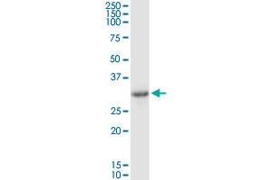 SULT1B1 MaxPab rabbit polyclonal antibody. (SULT1B1 抗体  (AA 1-296))
