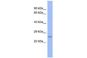 PSMB6 antibody used at 1 ug/ml to detect target protein. (PSMB6 抗体)