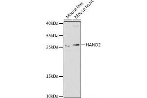 Western blot analysis of extracts of various cell lines using HAND2 Polyclonal Antibody at dilution of 1:1000. (HAND2 抗体)