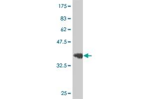 Western Blot detection against Immunogen (36. (EPH Receptor B3 抗体  (AA 899-997))