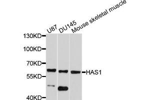 Western blot analysis of extracts of various cell lines, using HAS1 antibody (ABIN5997874) at 1/1000 dilution. (HAS1 抗体)