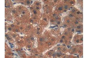 Figure. (MMP12 抗体  (AA 290-469))