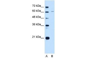 CDT1 antibody used at 1 ug/ml to detect target protein. (CDT1 抗体  (C-Term))