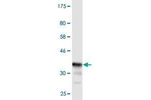 Western Blot detection against Immunogen (36. (CHST3 抗体  (AA 312-411))