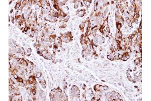 IHC-P Image Immunohistochemical analysis of paraffin-embedded HT29 xenograft , using Cytokeratin 20, antibody at 1:500 dilution. (KRT20 抗体  (C-Term))