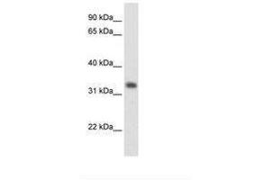 Image no. 1 for anti-3-Hydroxymethyl-3-Methylglutaryl-CoA Lyase (HMGCL) (AA 81-130) antibody (ABIN204975) (HMGCL 抗体  (AA 81-130))