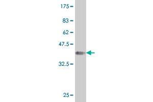 Western Blot detection against Immunogen (38. (HOXA5 抗体  (AA 91-200))