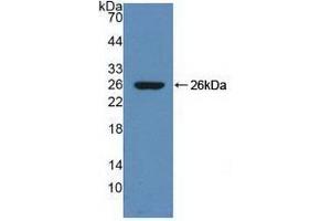 Detection of Recombinant ZPI, Rat using Polyclonal Antibody to Serpin A10 (SERPINA10) (SERPINA10 抗体  (AA 278-425))