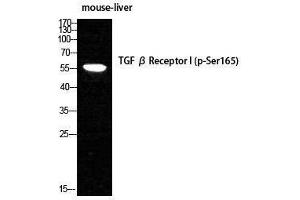 Western Blotting (WB) image for anti-Transforming Growth Factor, beta Receptor 1 (TGFBR1) (pSer165) antibody (ABIN6280717)