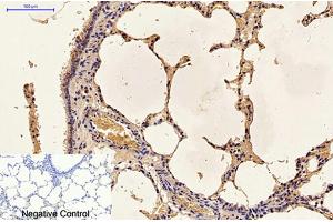Immunohistochemical analysis of paraffin-embedded rat lung tissue. (Caspase 9 抗体)