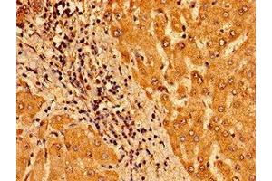 Immunohistochemistry of paraffin-embedded human liver tissue using ABIN7172938 at dilution of 1:100 (TM6SF2 抗体  (AA 290-331))