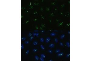 Immunofluorescence analysis of U-2 OS cells using NOLC1 antibody (ABIN6130597, ABIN6144708, ABIN6144709 and ABIN6221608) at dilution of 1:100. (NOLC1 抗体  (AA 400-699))