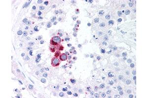 Anti-TBK1 antibody IHC of human testis. (TBK1 抗体  (AA 563-577))