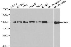Western Blotting (WB) image for anti-PRP3 Pre-mRNA Processing Factor 3 Homolog (PRPF3) antibody (ABIN1876670) (PRPF3 抗体)