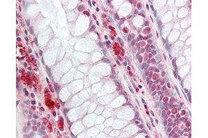 Human Colon: Formalin-Fixed, Paraffin-Embedded (FFPE).