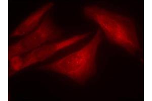 Immunofluorescence (IF) image for anti-GTPase Activating Protein (SH3 Domain) Binding Protein 1 (G3BP1) (pSer232) antibody (ABIN1870199) (G3BP1 抗体  (pSer232))
