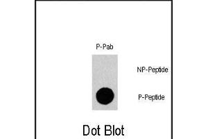 Dot blot analysis of Phospho-Gab1- polyclonal antibody (Cat. (GAB1 抗体  (pTyr659))