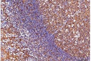 IHC analysis of ENO1 using anti-ENO1 antibody (ABIN7601902).