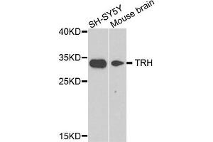 Western blot analysis of extract of SH-SY5Y and mouse brain cells, using TRH antibody. (TRH 抗体)