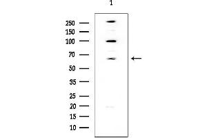 Western blot analysis of lysates from Hela cells, using C-RAF Mouse Monoclonal Antibody at 1/1000 dilution.