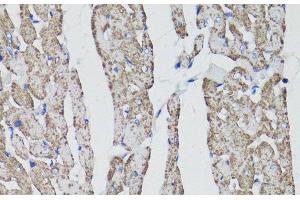 Immunohistochemistry of paraffin-embedded Rat heart using CD59 Polyclonal Antibody at dilution of 1:100 (40x lens). (CD59 抗体)