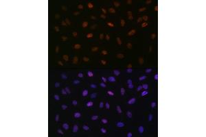 Immunofluorescence analysis of U-2 OS cells using L Rabbit mAb (ABIN7270266) at dilution of 1:100 (40x lens). (ASH2L 抗体)