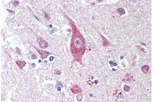 Human Brain, Cortex (formalin-fixed, paraffin-embedded) stained with ICOSLG antibody ABIN294881 at 1:50 followed by biotinylated anti-mouse IgG secondary antibody ABIN481714, alkaline phosphatase-streptavidin and chromogen. (ICOSLG 抗体)