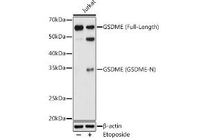 Western blot analysis of extracts of Jurkat cells, using GSDME antibody (ABIN6127757, ABIN6139554, ABIN6139555 and ABIN6223304) at 1:1000 dilution. (Non-Syndromic Hearing Impairment Protein 5 (GSDME) (AA 1-260) 抗体)