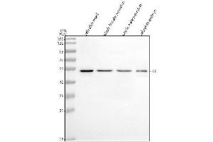 Western blot analysis of ILK using anti-ILK antibody (AZQ6PHD6-1).