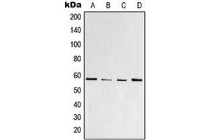 Western blot analysis of PPAR gamma (pS112) expression in HeLa colchicine-treated (A), Raw264. (PPARG 抗体  (pSer112))