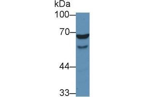 Detection of WASP in Human HL60 cell lysate using Polyclonal Antibody to Wiskott Aldrich Syndrome Protein (WASP) (WASP 抗体  (AA 39-251))