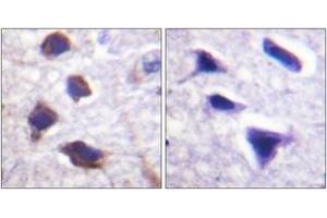 Immunohistochemistry analysis of paraffin-embedded human brain tissue, using Adrenergic Receptor beta2 (Ab-346) Antibody. (beta 2 Adrenergic Receptor 抗体  (AA 321-370))