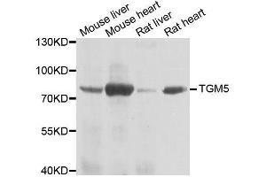 Western blot analysis of extracts of various cell lines, using TGM5 antibody. (Transglutaminase 5 抗体  (AA 461-720))