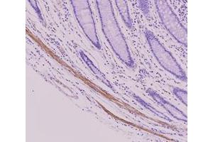 Immunohistochemistry (IHC) image for anti-Tubulin, beta 2B (TUBB2B) antibody (ABIN567611) (TUBB2B 抗体)