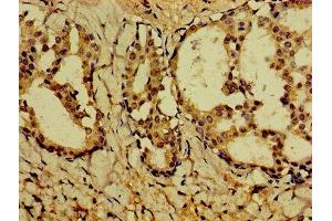 Immunohistochemistry (IHC) image for anti-Parvalbumin (PVALB) (AA 2-110) antibody (ABIN7162672)