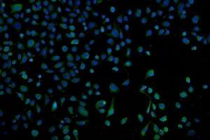 IF analysis of Proteasome 20S Beta 7/PSMB7 using anti-Proteasome 20S Beta 7/PSMB7 antibody (ABIN7600256).