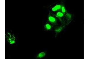 Image no. 2 for anti-SATB Homeobox 1 (SATB1) antibody (ABIN1500811) (SATB1 抗体)