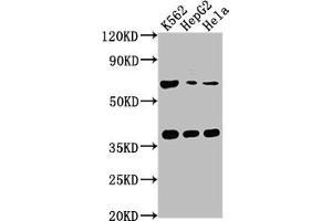 Western Blot Positive WB detected in: K562 whole cell lysate, HepG2 whole cell lysate, Hela whole cell lysate All lanes: CFHR5 antibody at 1:1000 Secondary Goat polyclonal to rabbit IgG at 1/50000 dilution Predicted band size: 65 kDa Observed band size: 65 kDa (CFHR5 抗体  (AA 374-569))