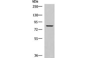 Western blot analysis of Human tongue tissue lysate using TGM3 Polyclonal Antibody at dilution of 1:800 (TGM3 抗体)